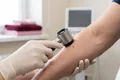 Cam kan alma tüpleri, dermatoskop ve katlanmış beyaz bez